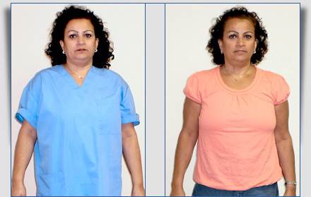 Success Story: Karen Lost 63 Pounds in 9 Months with Slimmy